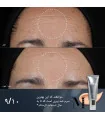 سرم کریستال رتینال 1 مدیک 8 - ضد چروک و سفت کننده پوست 1 - سرم کریستال رتینال 1 مدیک 8