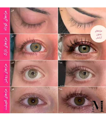 تصویر واقعی از تفاوت حجم و طول مژه‌ها پیش و پس از استفاده منظم سرم تقویت مژه گرند لش MD