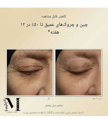 نتیجه قبل و بعد از استفاده کرم شب رتینول RoC - Retinol Correxion Deep Wrinkle Night Cream before after