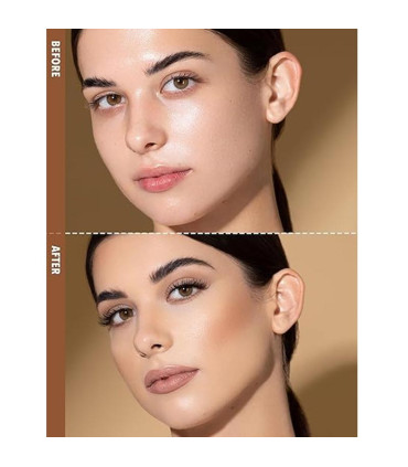 کانتور شیگلم گلدن سان روی گونه – قبل و بعد