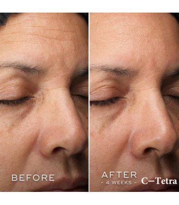 قبل و بعد از استفاده سرم ویتامین سی مدیک 8 مدل C-Tetra