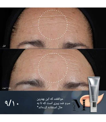 قبل و بعد از استفاده سرم کریستال رتینال 6 مدیک 8 - medik8 crystal retinal 6