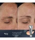 قبل و بعد از سرم کریستال رتینال 6 مدیک 8 - medik8 crystal retinal 6