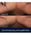 نتیجه قبل و بعد استفاده از کرم سوپریم استی لادر (Estée Lauder) Revitalizing Supreme+ با بهبود سفتی پوست و لیفت خط فک
