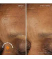 تصویر قبل و بعد از استفاده از کرم روز رتینول روک SPF30