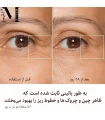 تصویر قبل و بعد آبرسانی پوست با مجیک کرم شارلوت تیلبری