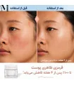مقایسه ظاهر قرمزی پوست قبل و بعد از استفاده از کرم مجیک واتر شارلوت تیلبری