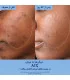 استفاده از سرم ضد لک کدلی Vinoperfect برای کاهش ظاهر لک‌های پوست