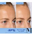 نتیجه استفاده از سرم ضد لک کدلی Vinoperfect پس از ۵۶ روز