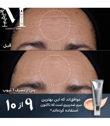نتیجه قبل و بعد از استفاده یک تیوب سرم کریستال رتینال ۱۰ مدیک ۸ و بهبود ظاهر خطوط و بافت پوست