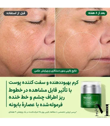 نتایج بالینی گزارش‌شده از کرم رتینال مورد در بهبود ظاهر چروک و افتادگی پوست