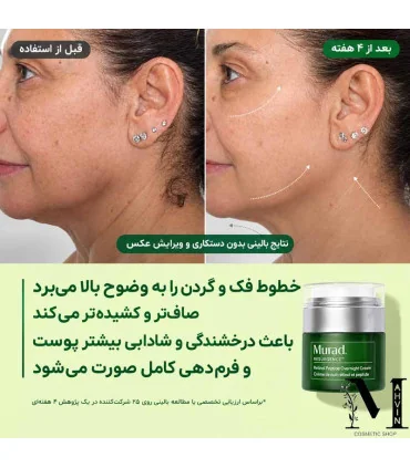 قبل و بعد از استفاده از کرم شب رتینال موراد روی پوست گردن در روتین شبانه