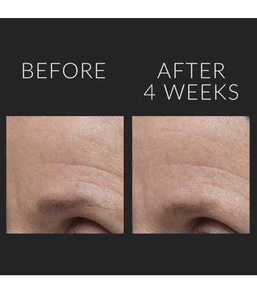 سرم لیفت صورت و ضد پیری کیت سامرویل Kate Somerville  - 4 هفته بعد از استفاده