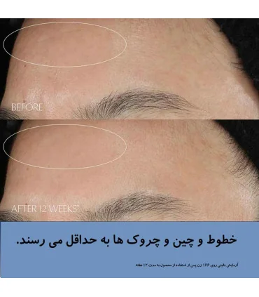 سرم استی لادر نایت ریپیر تاثیر بر روی خطوط و چین چروک پوست - پک استی لادر Advanced Night Repair