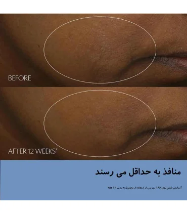 سرم استی لادر نایت ریپیر تاثیر بر روی منافذ پوست قبل و بعد از استفاده - پک استی لادر Advanced Night Repair