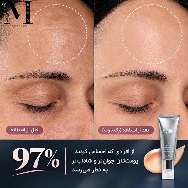 مقایسه قبل و بعد استفاده از کریستال رتینال مدیک ۸ برای بهبود ظاهر خطوط و بافت پوست
