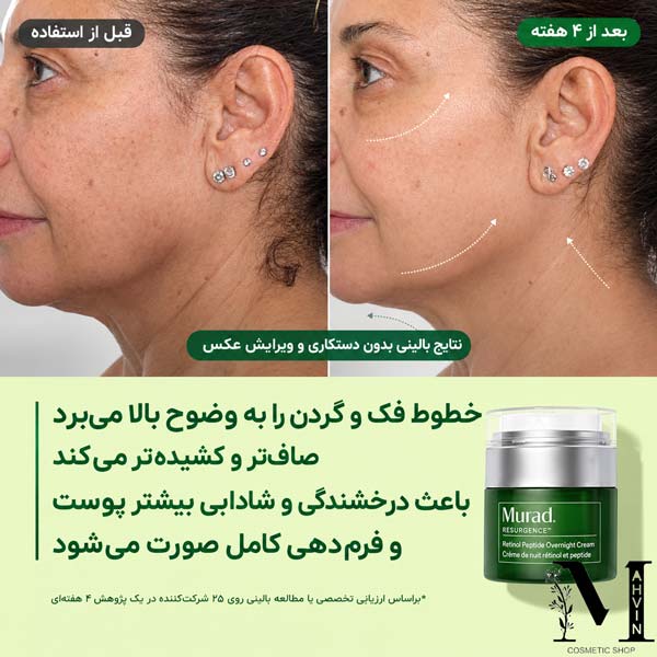 نتیجه قبل و بعد از استفاده کرم رتینال مورد روی گردن